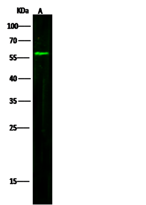 Clusterin/Apolipoprotein J/Apo-J/CLU Monoclonal Antibody - small - 3