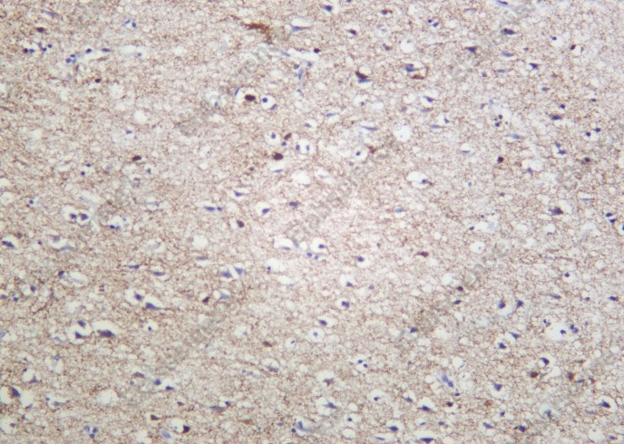 Recombinant GAD-65/67 Monoclonal Antibody - 2