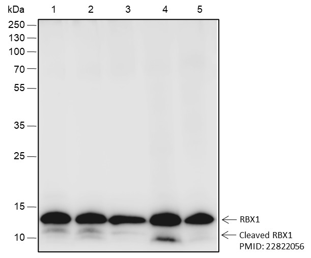 Recombinant RBX1 Monoclonal Antibody-searchlist-1