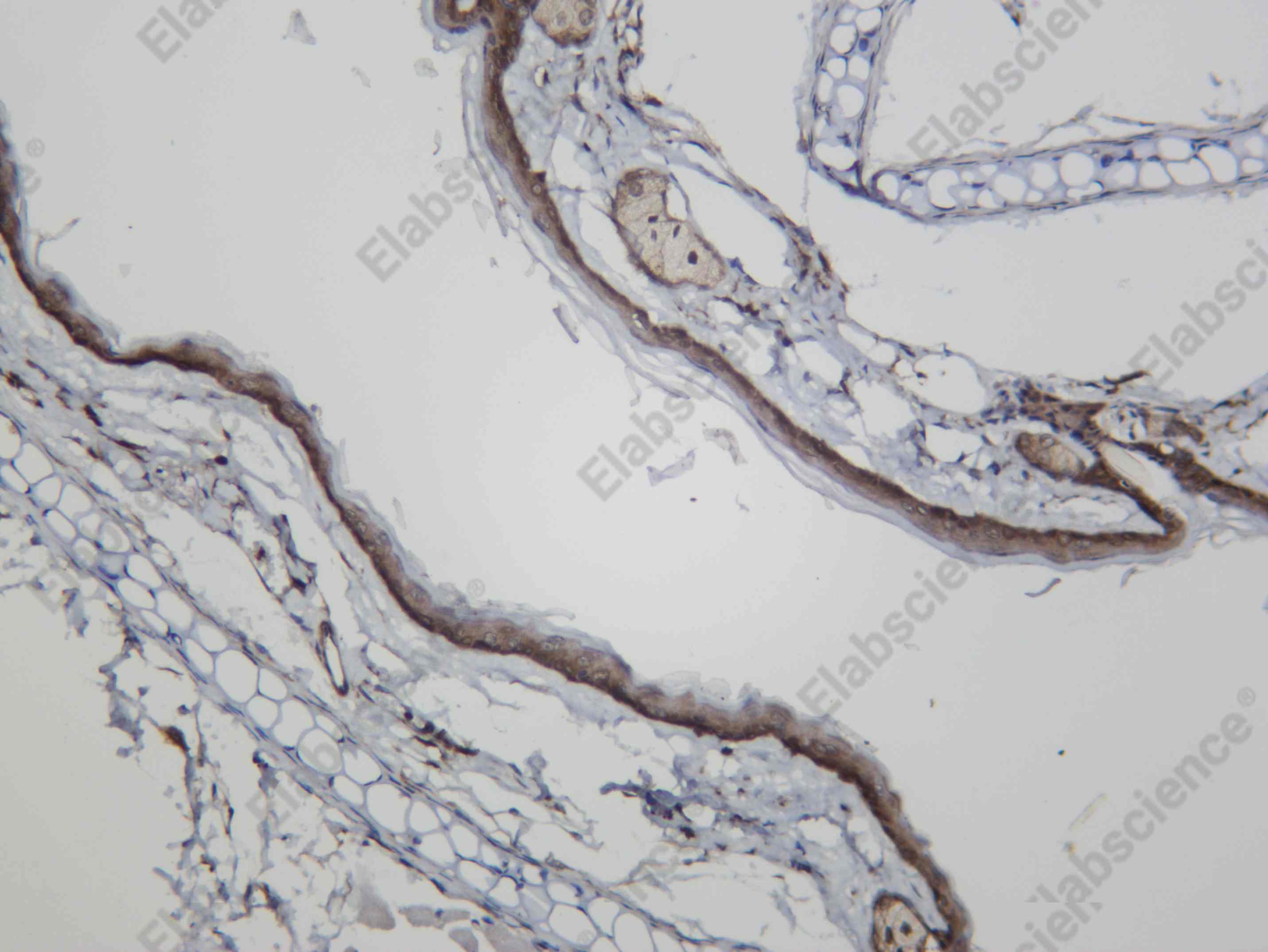 Recombinant PROF1 Monoclonal Antibody - 3