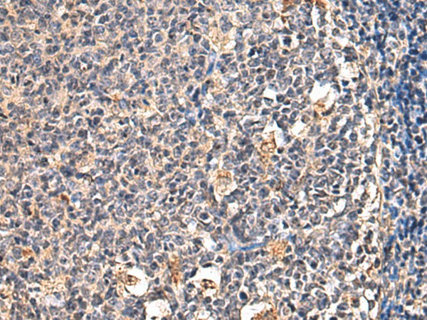 Immunohistochemistry of paraffin-embedded Human tonsil tissue  using ENTPD1 Polyclonal Antibody at dilution of 1:60(?200)