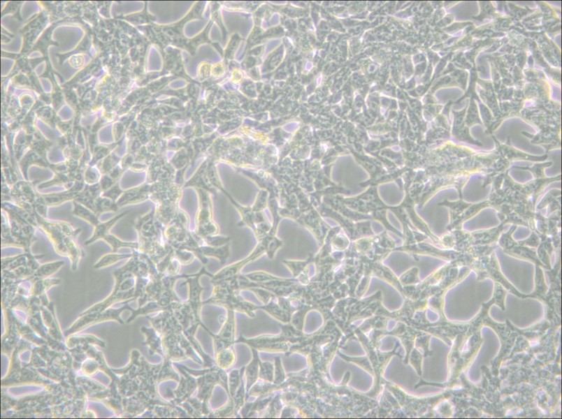 LNCaP clone FGC Cell Complete Medium - 6