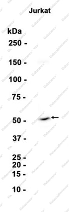 Recombinant BAF57 Monoclonal Antibody - 1