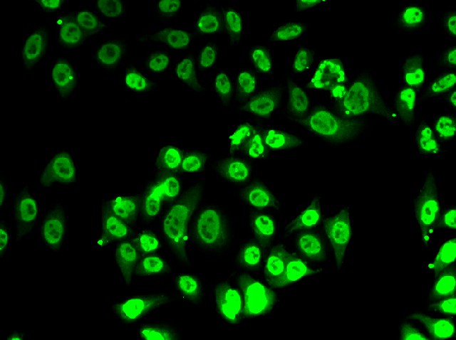 Immunofluorescence analysis of A-549 cells using FIP1L1 Polyclonal Antibody