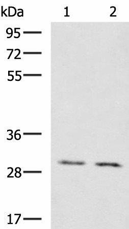 Western blot analysis of Mouse brain tissue Mouse kidney tissue lysates  using KRCC1 Polyclonal Antibody at dilution of 1:1350