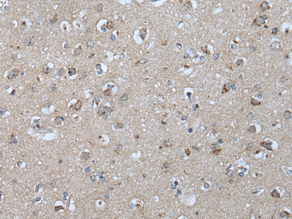 Immunohistochemistry of paraffin-embedded Human brain tissue  using VPS35 Polyclonal Antibody at dilution of 1:25(?200)