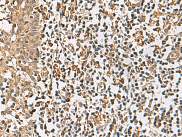 Immunohistochemistry of paraffin-embedded Human tonsil tissue  using DCAF12 Polyclonal Antibody at dilution of 1:65(?200)