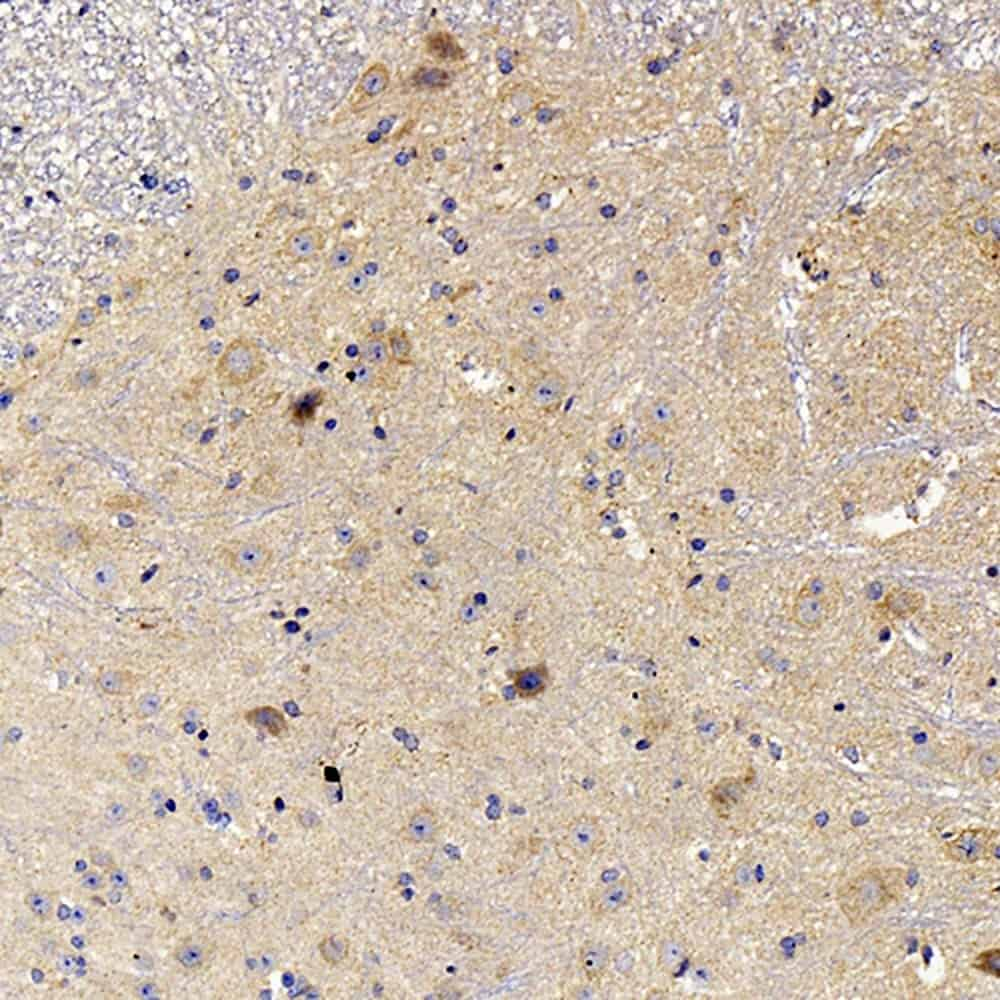 Immunohistochemistry analysis of paraffin-embedded mouse spinal marrow  using NOS2 Polyclonal Antibody at dilution of 1:500.