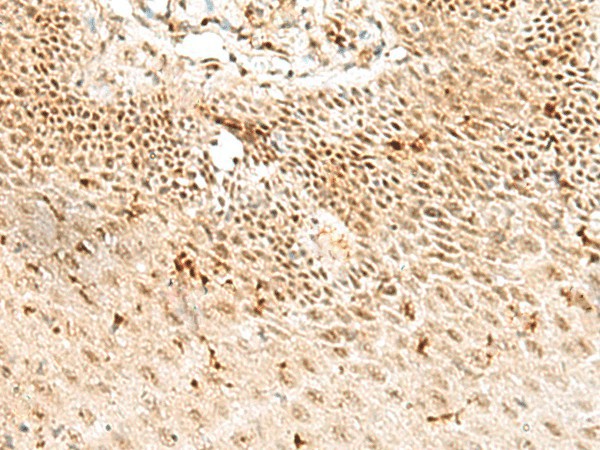 Immunohistochemistry of paraffin-embedded Human tonsil tissue  using RBM10 Polyclonal Antibody at dilution of 1:50(?200)