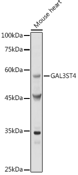 Western blot analysis of extracts of Mouse heart using GAL3ST4 Polyclonal Antibody at 1:1000 dilution.