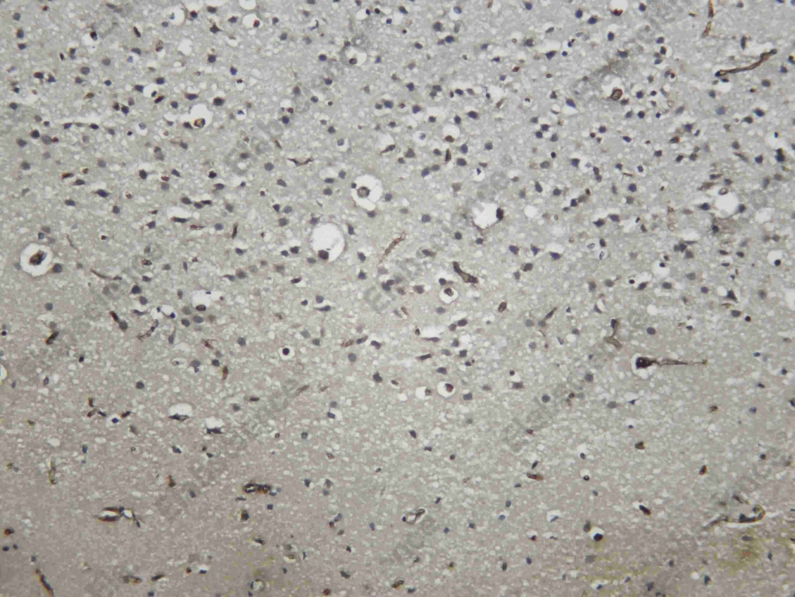 Recombinant C3 Monoclonal Antibody - 5