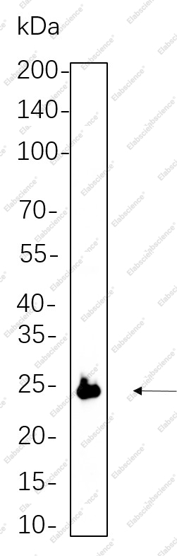 Recombinant eIF4E Monoclonal Antibody - 1