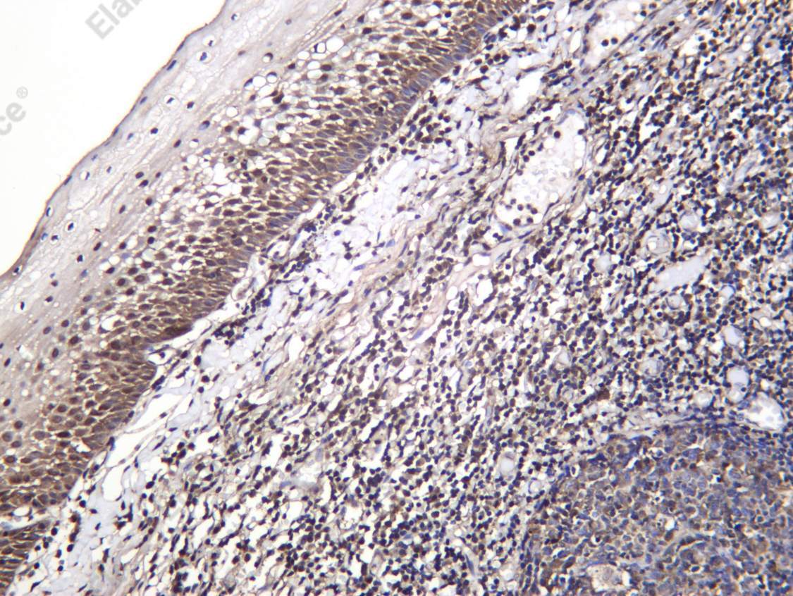 Recombinant PSMB9 Monoclonal Antibody - 2
