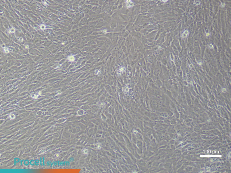 Human Mammary Cancer Fibroblast (Primary cell immortalization) Complete MediumHuman Mammary Cancer Fibroblast (Primary cell immortalization) Complete Medium - 3