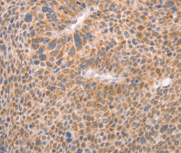 AASDHPPT Polyclonal Antibody - 2