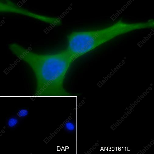 Recombinant NSE Monoclonal Antibody - 4