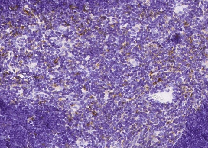 Recombinant CD180/RP105 Monoclonal Antibody-searchlist-1
