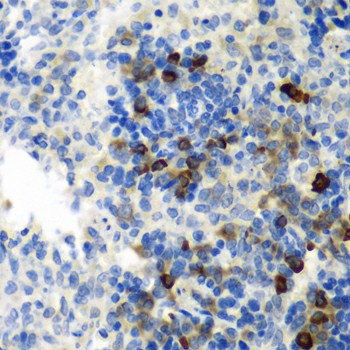 Immunohistochemistry of paraffin-embedded rat spleen using AIMP1 Polyclonal Antibody at dilution of 1:100 (40x lens).Perform microwave antigen retrieval with 10 mM PBS buffer pH 7.2 before commencing with IHC staining protocol.