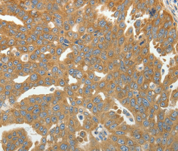 RPLP0 Polyclonal Antibody - 3