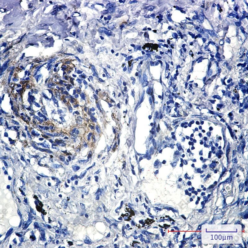Recombinant Caveolin 2 Monoclonal Antibody - 4
