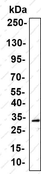 Recombinant CCDC109A Monoclonal Antibody - 1