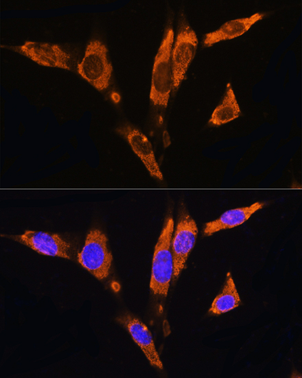 Immunofluorescence analysis of NIH/3T3 cells using C17orf74 Polyclonal Antibody at dilution of 1:100. Blue: DAPI for nuclear staining.