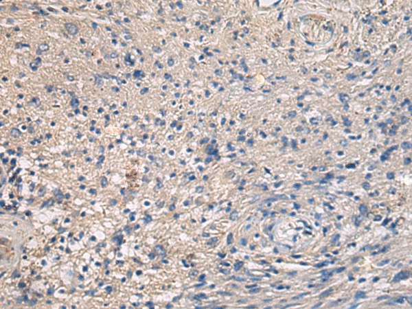 Immunohistochemistry of paraffin-embedded Human brain tissue  using MAPKAPK3 Polyclonal Antibody at dilution of 1:95(?200)