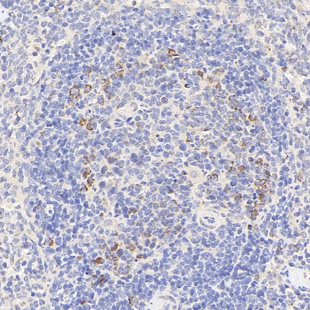 Immunohistochemistry analysis of paraffin-embedded rat spleen  using CCR5 Polyclonal Antibody at dilution of 1:300.