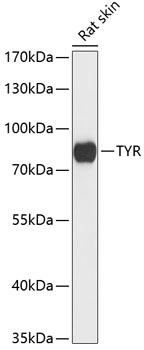 Western blot analysis of extracts of rat skin using Tyrosinase Polyclonal Antibody at 1:3000 dilution.