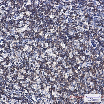 Recombinant DGKA Monoclonal Antibody - 3