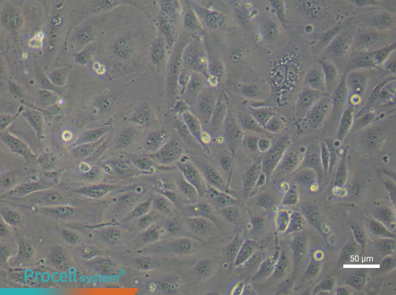 Human Umbilical Vein Endothelial (Primary cell immortalization) Cell Complete Medium - 4