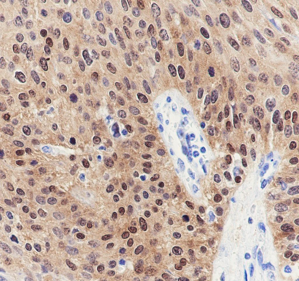 Recombinant CDKN2A/p16INK4a Monoclonal Antibody - 2