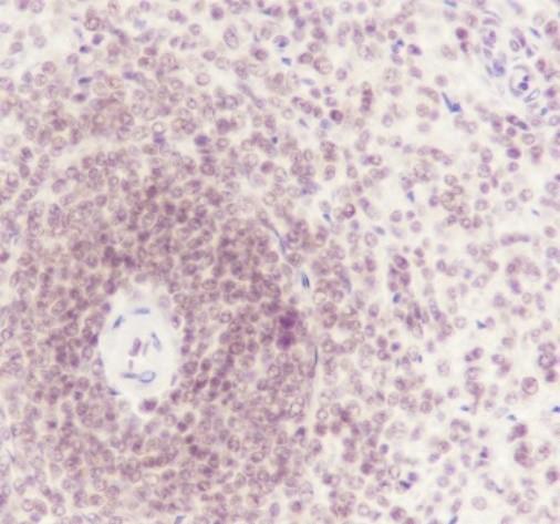 Recombinant ATF1 Monoclonal Antibody - small - 3
