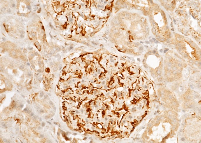Recombinant ARG1/Arginase 1 Monoclonal Antibody - small - 2