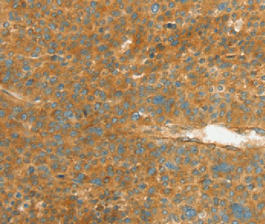 APOL2 Polyclonal Antibody - 2