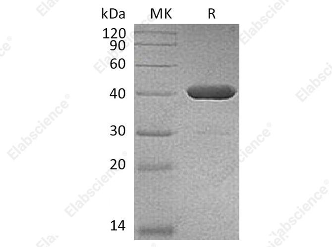 Recombinant Human IDO2 Protein (His Tag) - 1