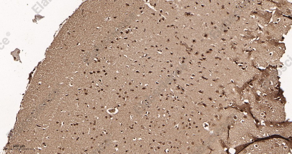 Recombinant TLS/FUS Monoclonal Antibody - 2