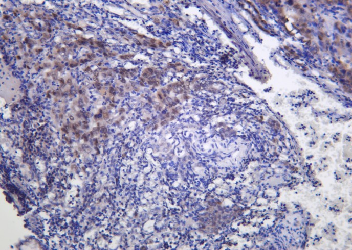Recombinant FRA1 Monoclonal Antibody-searchlist-1