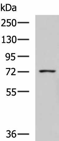 Western blot analysis of K562 cell lysate  using GUSB Polyclonal Antibody at dilution of 1:800