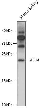 Western blot analysis of extracts of Mouse kidney using ADM Polyclonal Antibody at 1:1000 dilution.