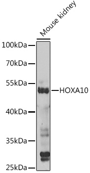 Western blot analysis of extracts of Mouse kidney using HOXA10 Polyclonal Antibody at 1:1000 dilution.