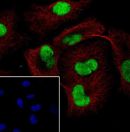 Recombinant AKT1+AKT2+AKT3 Monoclonal Antibody - small - 6
