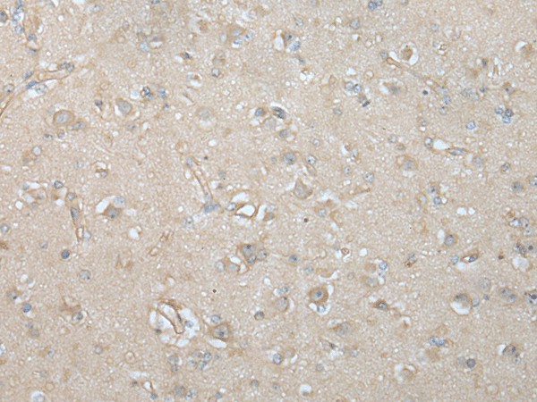 Immunohistochemistry of paraffin-embedded Human brain tissue  using VILL Polyclonal Antibody at dilution of 1:65(?200)