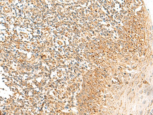 Immunohistochemistry of paraffin-embedded Human tonsil tissue  using MRPS18B Polyclonal Antibody at dilution of 1:35(?200)