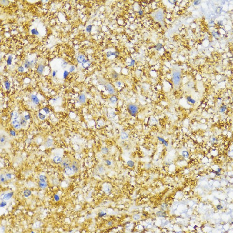 Immunohistochemistry of paraffin-embedded Mouse spinal cord using SYP Polyclonal Antibody at dilution of  1:100 (40x lens).