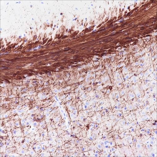 Recombinant MAG Monoclonal Antibody - small - 5