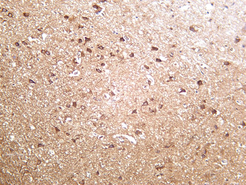 Recombinant DRP1 Monoclonal Antibody - 2