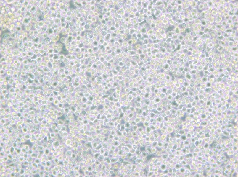 PC 61 5.3 [PC 61; PC 61.5.3] Cell Complete Medium - small - 5