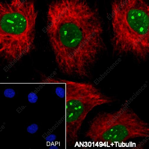 Recombinant Cleaved PARP1 p25 Monoclonal Antibody - 4