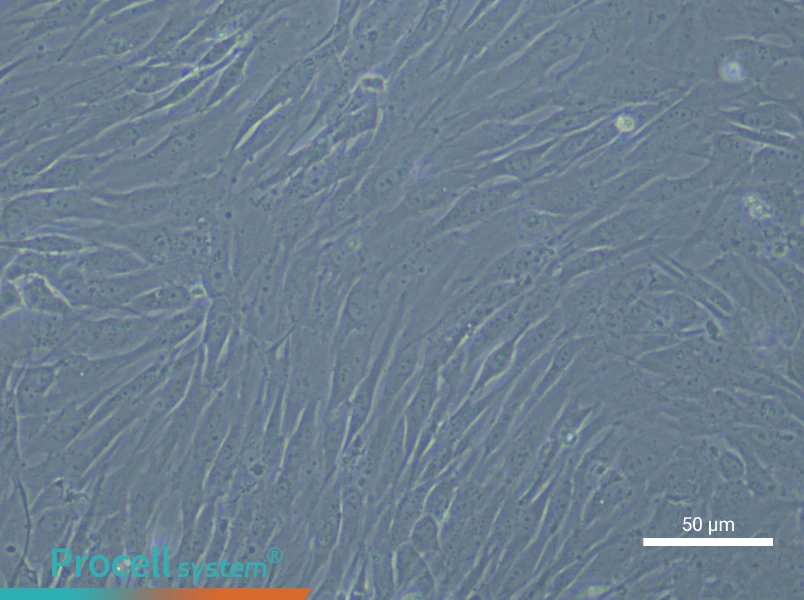 Human Aortic Smooth Muscle (Primary cell immortalization) Cell Complete Medium - 4